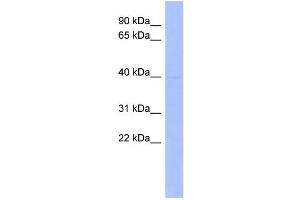 WB Suggested Anti-MEIS1 Antibody Titration:  0. (MEIS1 anticorps  (Middle Region))