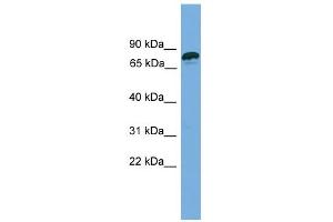WB Suggested Anti-ZNF790 Antibody Titration:  0. (ZNF790 anticorps  (N-Term))