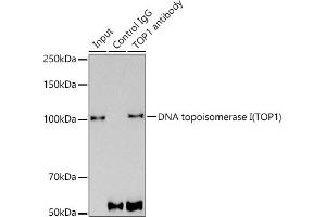 Immunoprecipitation analysis of 300 μg extracts of MCF7 cells using 3 μg DNA topoisomerase I (TOP1) antibody (ABIN7270850).
