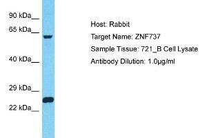 Host: Rabbit Target Name: ZNF737 Sample Type: 721_B Whole Cell lysates Antibody Dilution: 1. (ZNF737 anticorps  (N-Term))