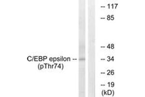 Western blot analysis of extracts from HuvEc cells treated with UV 15', using C/EBP-epsilon (Phospho-Thr74) Antibody. (CEBPE anticorps  (pThr74))