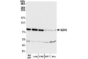 Western Blotting (WB) image for anti-Enhancer of Zeste Homolog 2 (EZH2) (AA 696-746) antibody (ABIN7450991)