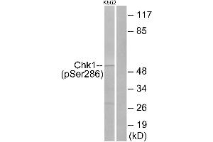 Western blot analysis of extracts from K562 cells, treated with Na3VO4 (0. (CHEK1 anticorps  (pSer286))