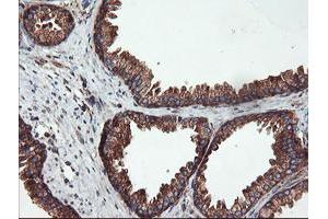 anti-Ubiquitin Specific Peptidase 9, X-Linked (USP9X) (AA 2246-2570) antibody