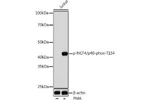Western blot analysis of extracts of Jurkat cells, using Phospho-NCF4/p40-phox-T154 antibody (ABIN7268901) at 1:1000 dilution.