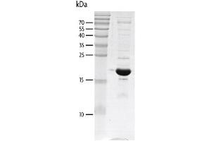Recombinant p300 (1041-1161) protein gel.