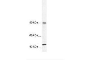 Image no. 3 for anti-RNA Binding Motif Protein 10 (RBM10) (AA 39-88) antibody (ABIN202954) (RBM10 anticorps  (AA 39-88))
