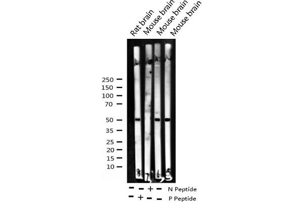 ATF2 anticorps  (pThr51, pThr69)