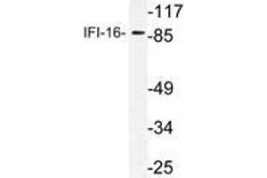 Western blot (WB) analysis of IFI-16 antibody in extracts from HepG2 cells. (IFI16 anticorps)