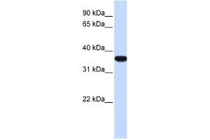 WB Suggested Anti-HMOX1 Antibody Titration: 0. (HMOX1 anticorps  (N-Term))