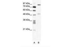 Image no. 1 for anti-Matrix Metallopeptidase 10 (Stromelysin 2) (MMP10) (N-Term) antibody (ABIN202622) (MMP10 anticorps  (N-Term))