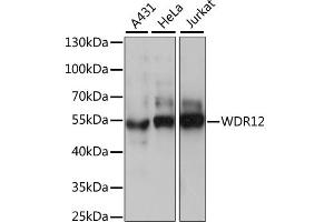 Western blot analysis of extracts of various cell lines, using WDR12 antibody. (WDR12 anticorps)