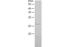 Western Blotting (WB) image for Noggin (NOG) (AA 28-232) protein (His-IF2DI Tag) (ABIN7124188)