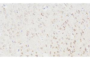 Immunohistochemistry analysis of paraffin-embedded Rat brain using NOS1 Polyclonal Antibody at dilution of 1:300. (NOS1 anticorps)