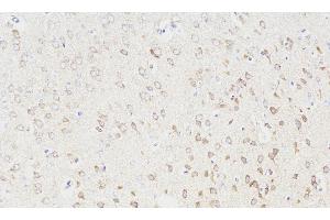 Immunohistochemistry analysis of paraffin-embedded Rat brain using NOS1 Polyclonal Antibody at dilution of 1:300.