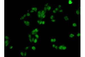 Immunofluorescent analysis of HepG2 cells using nacHU at dilution of 1:100 and Alexa Fluor 488-congugated AffiniPure Goat Anti-Rabbit IgG(H+L) (Histone H1.1 anticorps)