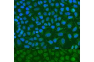Immunofluorescence analysis of A549 cells using SSX5 Polyclonal Antibody (SSX5 anticorps)