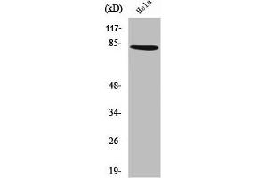 Western Blot analysis of HeLa cells using ZNF225 Polyclonal Antibody (ZNF225 anticorps  (C-Term))