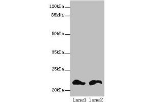 Western blot All lanes: FKBP11 antibody at 6 μg/mL Lane 1: Mouse spleen tissue Lane 2: Mouse liver tissue Secondary Goat polyclonal to rabbit IgG at 1/10000 dilution Predicted band size: 23, 16 kDa Observed band size: 23 kDa (FKBP11 anticorps  (AA 28-154))