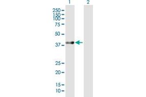 Western Blot analysis of ACAT2 expression in transfected 293T cell line by ACAT2 MaxPab polyclonal antibody. (ACAT2 anticorps  (AA 1-397))