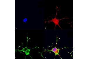 Immunocytochemistry/Immunofluorescence analysis using Mouse Anti-Dicer Monoclonal Antibody, Clone S167-7 (ABIN2483003).