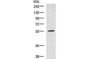 Western blot analysis of A549 cell lysate using CEP57 Polyclonal Antibody at dilution of 1:600 (CEP57 anticorps)