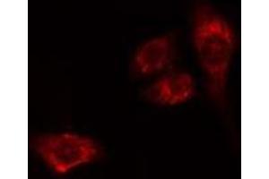 ABIN6275534 staining HeLa cells by IF/ICC. (PLK2 anticorps  (Internal Region))