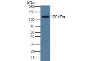 Detection of C3a in Human Serum using Polyclonal Antibody to Complement Component 3a (C3a) (C3a anticorps  (AA 672-748))