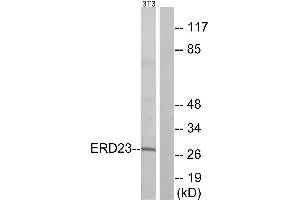Western blot analysis of extracts from NIH/3T3 cells, using ERD23 antibody. (KDELR3 anticorps  (Internal Region))