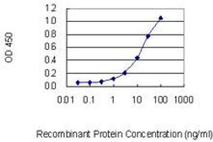 Detection limit for recombinant GST tagged TCOF1 is 0.
