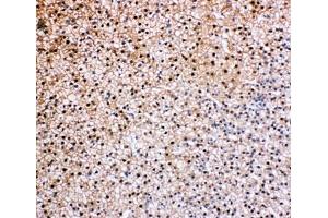 IHC-P: VCP antibody testing of rat epinephros tissue (VCP anticorps  (C-Term))