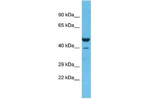 Host:  Rabbit  Target Name:  ZNF589  Sample Type:  Lung Tumor lysates  Antibody Dilution:  1. (ZNF589 anticorps  (C-Term))