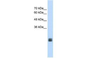 WB Suggested Anti-MGC33926 Antibody Titration:  1. (TMEM178 anticorps  (Middle Region))