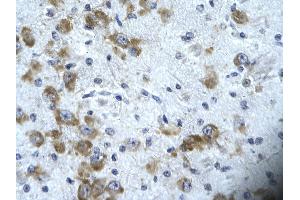 Rabbit Anti-CIC Antibody       Paraffin Embedded Tissue:  Human neural cell   Cellular Data:  Epithelial cells of renal tubule  Antibody Concentration:   4.