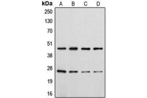 Western blot analysis of CD28 (pY218) expression in HeLa colchicine-treated (A), Jurkat (B), Raw264. (CD28 anticorps  (C-Term, pTyr218))