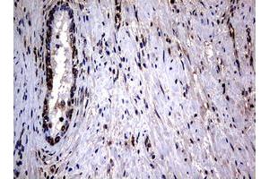 Image no. 2 for anti-RAS Guanyl Releasing Protein 3 (Calcium and DAG-Regulated) (RASGRP3) (AA 380-690) antibody (ABIN1491477)