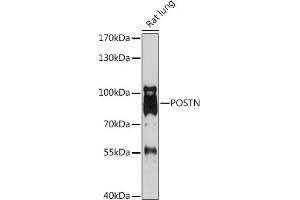 Western blot analysis of extracts of Rat lung, using POSTN antibody (ABIN7269227) at 1:1000 dilution.