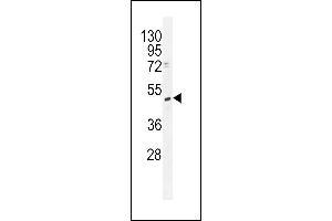 TRMT2B Antibody (N-term) (ABIN655117 and ABIN2844748) western blot analysis in K562 cell line lysates (35 μg/lane). (TRMT2B anticorps  (N-Term))