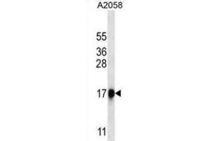 Western Blotting (WB) image for anti-Chymotrypsin-Like Elastase Family, Member 1 (CELA1) antibody (ABIN2999709) (CELA1 anticorps)
