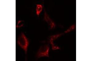 ABIN6275642 staining Hela cells by IF/ICC. (EIF2B3 anticorps  (Internal Region))