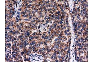 Image no. 4 for anti-Family with Sequence Similarity 127, Member C (FAM127C) antibody (ABIN1498197) (FAM127C anticorps)