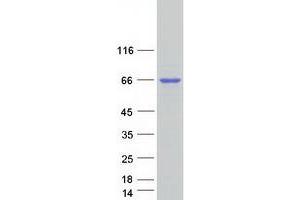 Validation with Western Blot