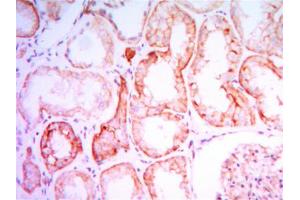 Immunohistochemical analysis of paraffin-embedded human kidney tissues using PTH1R mouse mAb with DAB staining. (PTH1R anticorps)