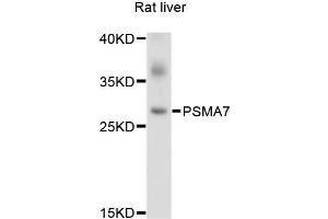 Western blot analysis of extracts of Rat liver cells, using PSMA7 antibody. (PSMA7 anticorps)