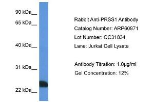 Western Blotting (WB) image for anti-Protease, serine, 1 (Trypsin 1) (PRSS1) (N-Term) antibody (ABIN2788638) (PRSS1 anticorps  (N-Term))