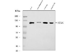 Western blot analysis of Nedd4 using anti-Nedd4 antibody (ABIN7602341).