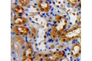 IHC-P analysis of Kidney tissue, with DAB staining. (NR3C2 anticorps  (AA 739-984))