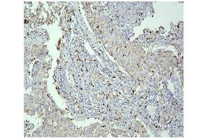 IHC analysis of PPT1 using anti PPT1 antibody (ABIN6719501).