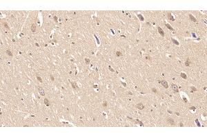 Detection of INSR in Human Cerebrum Tissue using Monoclonal Antibody to Insulin Receptor (INSR)