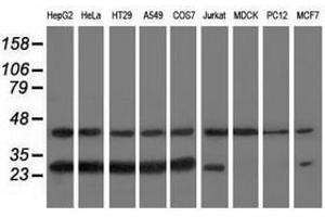 Image no. 2 for anti-RAB, Member of RAS Oncogene Family-Like 2A (RABL2A) antibody (ABIN1500577) (RABL2A anticorps)